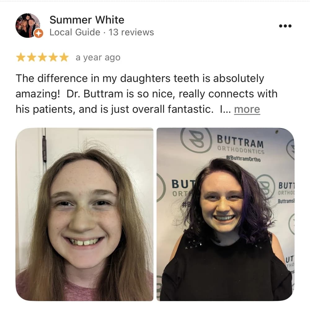 Summer White’s five-star review of Buttram Orthodontics